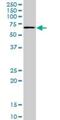 T-Box 18 antibody, H00009096-M05, Novus Biologicals, Western Blot image 