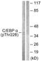 CCAAT Enhancer Binding Protein Alpha antibody, PA5-38429, Invitrogen Antibodies, Western Blot image 