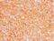 Aminoacyl TRNA Synthetase Complex Interacting Multifunctional Protein 1 antibody, PA5-21644, Invitrogen Antibodies, Immunohistochemistry paraffin image 