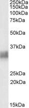 Bone Marrow Stromal Cell Antigen 2 antibody, STJ72193, St John