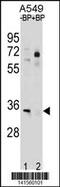 ATPase Na+/K+ Transporting Subunit Beta 2 antibody, 60-685, ProSci, Western Blot image 