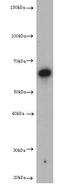 Phosphatidylinositide phosphatase SAC1 antibody, abx115368, Abbexa, Enzyme Linked Immunosorbent Assay image 