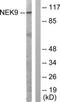 NIMA Related Kinase 9 antibody, TA312627, Origene, Western Blot image 