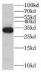 Myozenin 1 antibody, FNab05522, FineTest, Western Blot image 