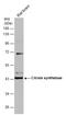 Citrate Synthase antibody, GTX628144, GeneTex, Western Blot image 