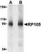 CD180 Molecule antibody, PA5-20251, Invitrogen Antibodies, Western Blot image 