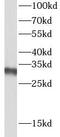 Lactamase Beta 2 antibody, FNab04673, FineTest, Western Blot image 