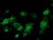 Mahogunin Ring Finger 1 antibody, MA5-25497, Invitrogen Antibodies, Immunocytochemistry image 
