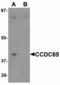 Coiled-Coil Domain Containing 69 antibody, LS-C108698, Lifespan Biosciences, Western Blot image 