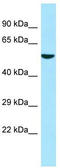 Atlastin GTPase 3 antibody, TA338063, Origene, Western Blot image 