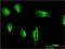 Phosphatidylinositol-4-Phosphate 3-Kinase Catalytic Subunit Type 2 Alpha antibody, H00005286-M05, Novus Biologicals, Immunofluorescence image 