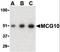 Poly(RC) Binding Protein 4 antibody, orb86737, Biorbyt, Western Blot image 