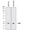 Retinol Binding Protein 4 antibody, MAB34762, R&D Systems, Western Blot image 