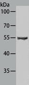 Spermatogenesis Associated 6 antibody, TA322284, Origene, Western Blot image 