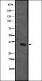 Activated Leukocyte Cell Adhesion Molecule antibody, orb335122, Biorbyt, Western Blot image 