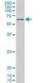 Peroxisome Proliferator Activated Receptor Delta antibody, H00005467-M03, Novus Biologicals, Western Blot image 