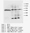 Lipoprotein Lipase antibody, LS-C172096, Lifespan Biosciences, Western Blot image 