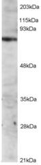 ITK antibody, EB05117, Everest Biotech, Western Blot image 