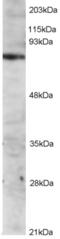 IL2 Inducible T Cell Kinase antibody, EB05117, Everest Biotech, Western Blot image 