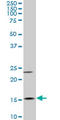 Myosin Light Chain 6 antibody, LS-C139197, Lifespan Biosciences, Western Blot image 