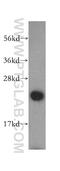 Deoxythymidylate Kinase antibody, 15360-1-AP, Proteintech Group, Western Blot image 