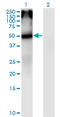 Cholinergic Receptor Nicotinic Alpha 5 Subunit antibody, LS-C196915, Lifespan Biosciences, Western Blot image 