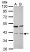 Transaldolase 1 antibody, GTX114956, GeneTex, Western Blot image 