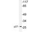 Cyclin Dependent Kinase Inhibitor 1B antibody, LS-C177748, Lifespan Biosciences, Western Blot image 