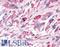 Protein Kinase D3 antibody, LS-A7346, Lifespan Biosciences, Immunohistochemistry frozen image 