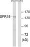 SR-Related CTD Associated Factor 4 antibody, TA315662, Origene, Western Blot image 
