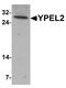 Yippee Like 2 antibody, A14962, Boster Biological Technology, Western Blot image 
