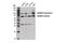 ADAM Metallopeptidase Domain 10 antibody, 14194S, Cell Signaling Technology, Western Blot image 