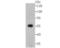 Ubiquitin Specific Peptidase 14 antibody, NBP2-75700, Novus Biologicals, Western Blot image 