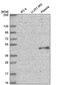 ELOVL Fatty Acid Elongase 5 antibody, PA5-65849, Invitrogen Antibodies, Western Blot image 