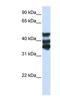 Homogentisate 1,2-Dioxygenase antibody, NBP1-55134, Novus Biologicals, Western Blot image 
