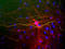 Neurofilament Light antibody, LS-B10376, Lifespan Biosciences, Immunocytochemistry image 