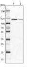 Peroxisomal Biogenesis Factor 6 antibody, NBP1-80955, Novus Biologicals, Western Blot image 