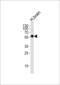 Cyclin Dependent Kinase 14 antibody, MBS9206053, MyBioSource, Western Blot image 