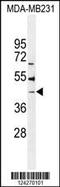 Beta-1,4-Galactosyltransferase 6 antibody, MBS9210579, MyBioSource, Western Blot image 