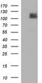 Integrin Subunit Beta 6 antibody, NBP2-45462, Novus Biologicals, Western Blot image 