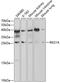 Regenerating Family Member 1 Alpha antibody, A03075-1, Boster Biological Technology, Western Blot image 