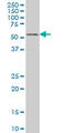 GA Binding Protein Transcription Factor Subunit Alpha antibody, LS-C133213, Lifespan Biosciences, Western Blot image 