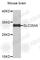 ADP/ATP translocase 2 antibody, A9308, ABclonal Technology, Western Blot image 