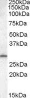 Methylenetetrahydrofolate Dehydrogenase (NADP+ Dependent) 2 Like antibody, PA5-18916, Invitrogen Antibodies, Western Blot image 