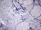 Methylmalonyl-CoA epimerase, mitochondrial antibody, LS-C791697, Lifespan Biosciences, Immunohistochemistry paraffin image 