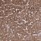 Proteasome 26S Subunit, Non-ATPase 6 antibody, PA5-57870, Invitrogen Antibodies, Immunohistochemistry paraffin image 