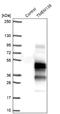 Transmembrane Protein 139 antibody, NBP1-83439, Novus Biologicals, Western Blot image 