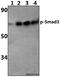 SMAD Family Member 3 antibody, A00059S425, Boster Biological Technology, Western Blot image 