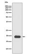 Myosin Light Chain 2 antibody, M03215, Boster Biological Technology, Western Blot image 