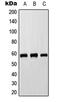 Cytochrome P450 Family 8 Subfamily B Member 1 antibody, MBS821242, MyBioSource, Western Blot image 